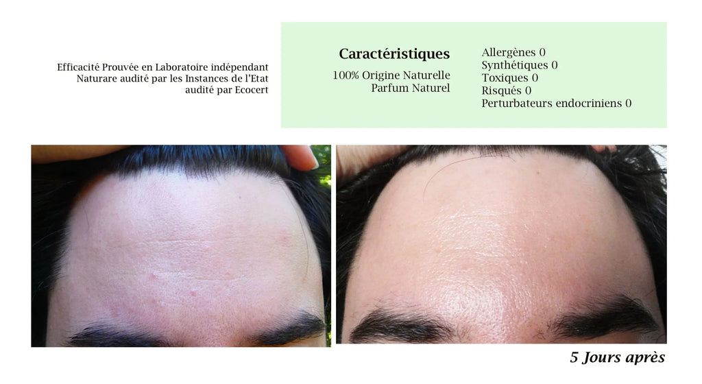 MERVEILLE DES LANDES BIO - Soin de peau Sensible Régénération Intégrale Visage-12